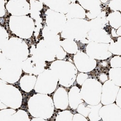 ZNF687 Antibody, Novus Biologicals 0.1mL; Unlabeled:Antibodies, Polyclonal